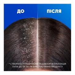 Шампунь Head & Shoulders Яблочная свежесть 400 мл Фото 3